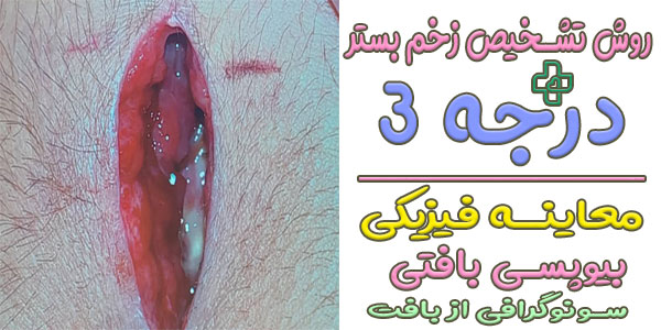 روش های تشخیص زخم بستر درجه ۳ چیست؟