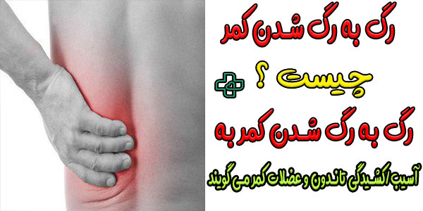 رگ به رگ شدن کمر دقیقا چیست؟
