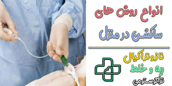 ساکشن در منزل چند نوع روش انجام دارد؟