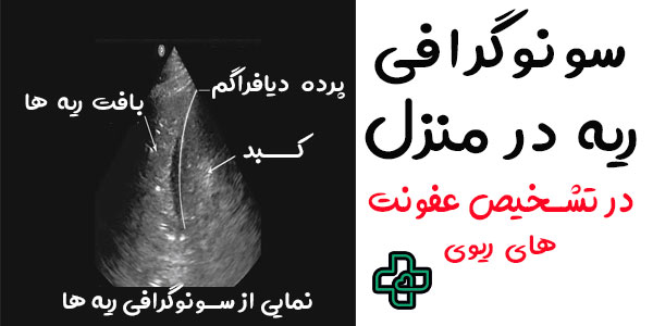 سونوگرافی ریه در منزل