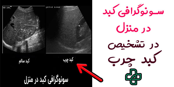 سونوگرافی کبد در منزل
