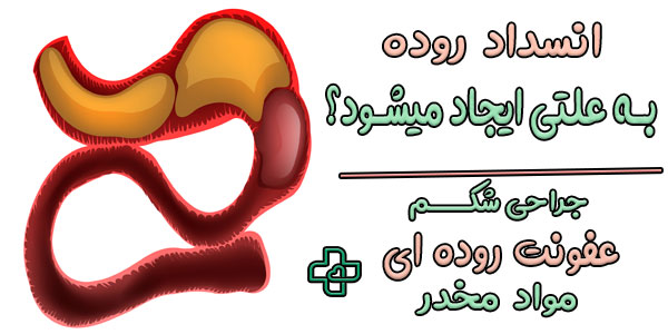 شایع ترین علت انسداد روده چیست؟
