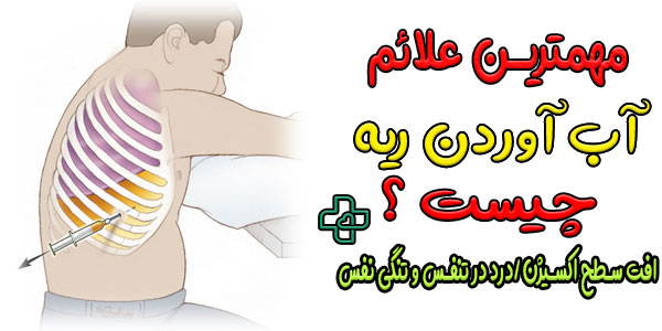 علائم آب آوردن ریه (پلورال افیوژن) چیست؟