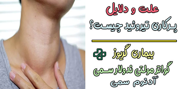 علت هایپرتیروئیدیسم چیست؟ (علت بوجود آمدن تیروئید پرکار)
