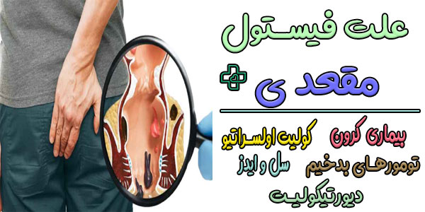 علت بیماری فیستول مقعدی چیست؟