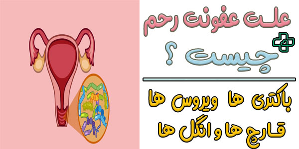 علت عفونت رحم چیست؟