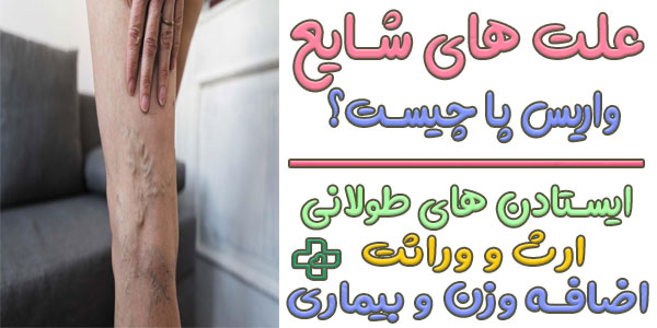 علت واریس پا چیست؟