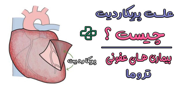 علت پریکاردیت چیست؟