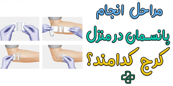 مراحل انجام پانسمان و تعویض پانسمان در منزل کرج کدامند؟