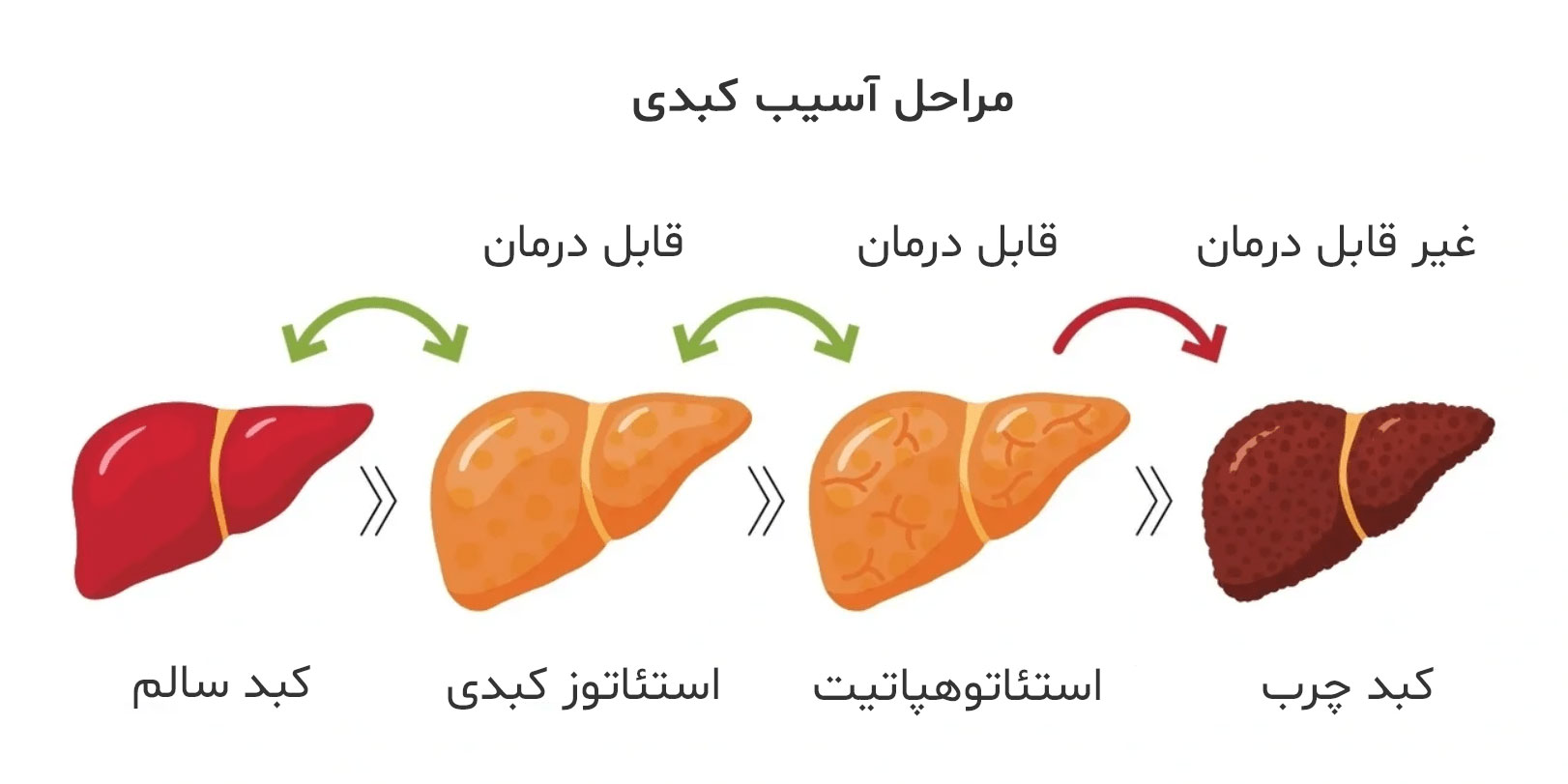 مراحل کبد چرب گرید 1