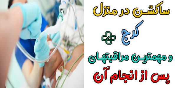 مراقبتهای پرستاری پس از انجام خدمات ساکشن در منزل کرج