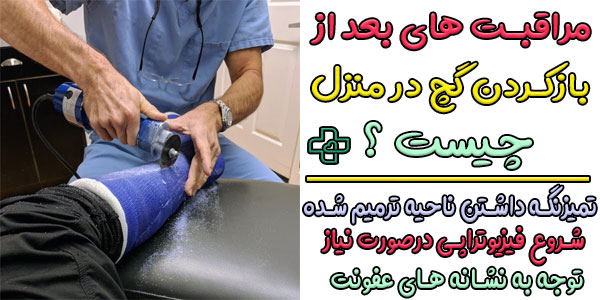 مراقبت های بعد از باز کردن گچ در منزل