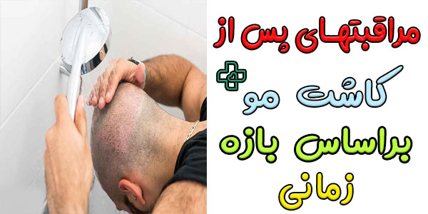 مراقبت های بعد از کاشت مو (براساس تایم زمانی)