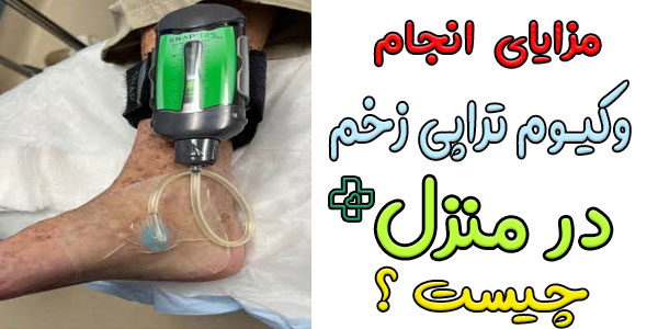 مزایای انجام وکیوم تراپی زخم در منزل چیست؟