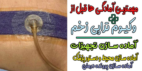 مهمترین آمادگی ها و تمهیدات لازم قبل از انجام وکیوم تراپی در منزل چیست؟