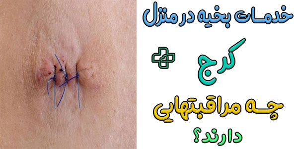 مهمترین مراقبتهای پرستاری پس از بخیه در منزل کرج چیست؟
