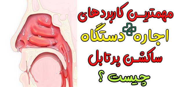 مهمترین کاربردهایی که از اجاره دستگاه ساکشن پرتابل داریم چیست؟