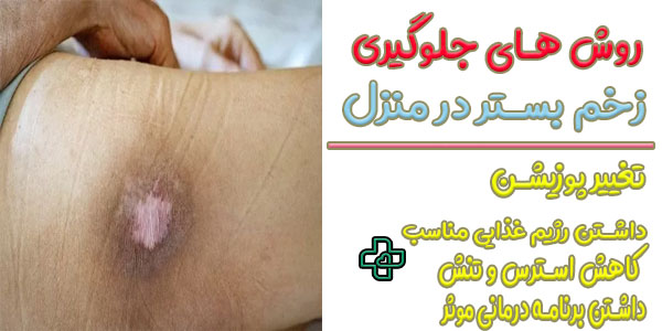 مهم ترین روش های جلوگیری از ایجاد زخم بستر در منزل