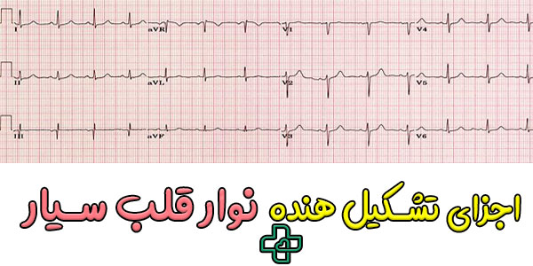 نتایج نوار قلب سیار از چه بخش هایی تشکیل شده است؟