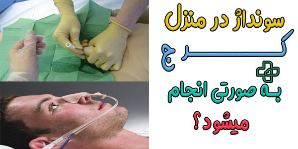 نحوه انجام سونداز در منزل کرج به چه صورتی است؟