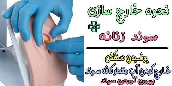 نحوه درآوردن سوند زنان به چه صورتی است؟