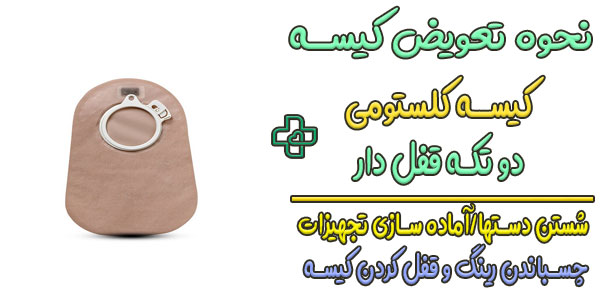 نحوه نصب کیسه کلستومی دو تکه
