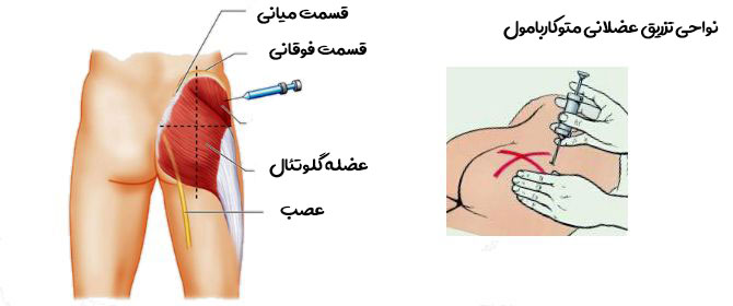 نواحی تزریق متوکاربامول
