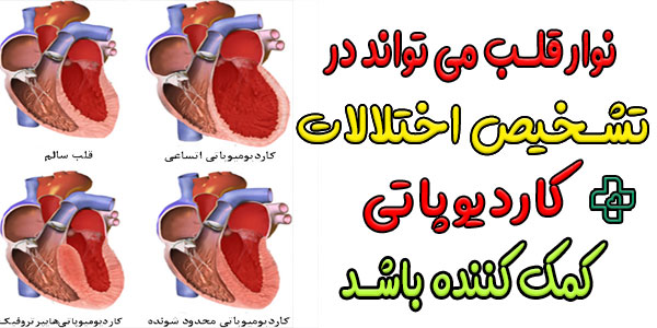 نوار قلب برای تشخیص بیماری های کاردیومیوپاتی