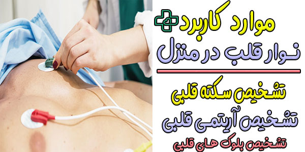 نوار قلب در منزل در چه مواردی کاربرد دارد؟