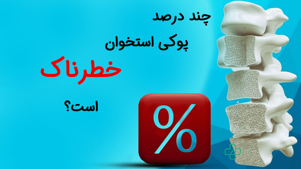 چند درصد پوکی استخوان خطرناک است؟