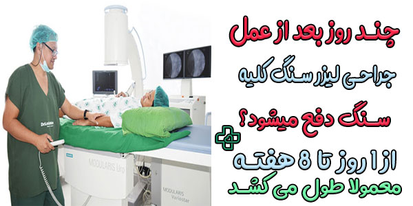 چند روز بعد از سنگ شکن سنگ دفع می شود؟