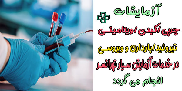 چه آزمایش هایی در خدمات آزمایش در منزل تهرانسر انجام میشود؟