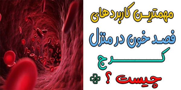 کاربردهای فصد خون در منزل کرج چیست؟