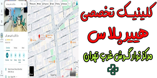 کلینیک تخصصی گوش و شنوایی و نوار گوش هییرپلاس