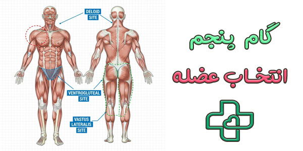 گام 5 (انتخای محل تزریق)