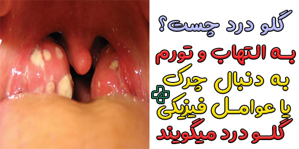 گلو درد چیست و چه علائمی دارد؟